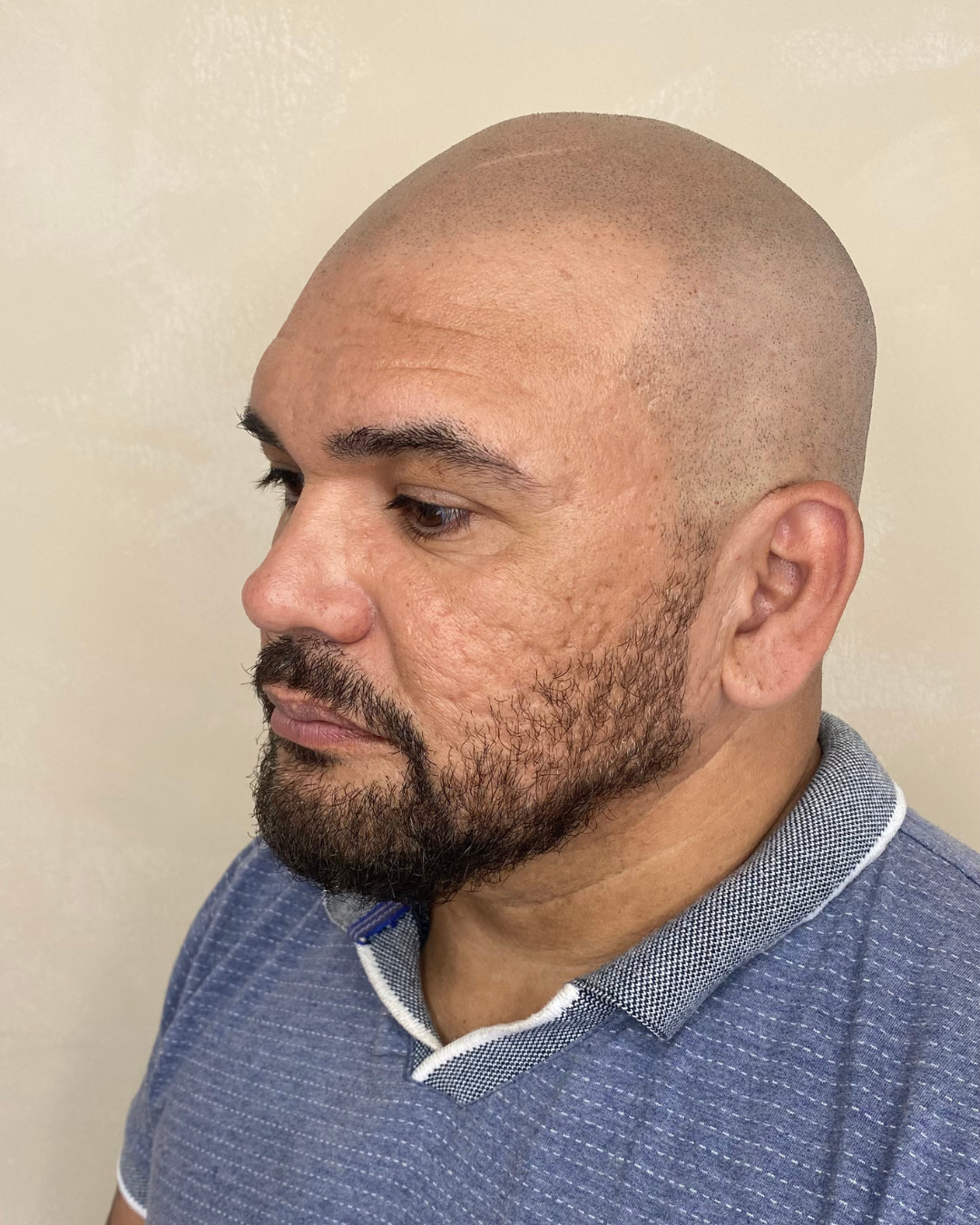 Después — Efecto Afeitado 2